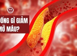 Uống gì để giảm mỡ máu? Bật mí 5 dược liệu quen thuộc, dễ tìm